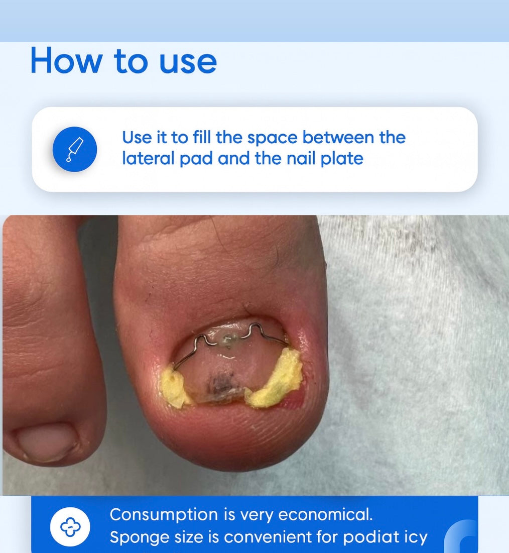 PodolJest sponges, 30pc