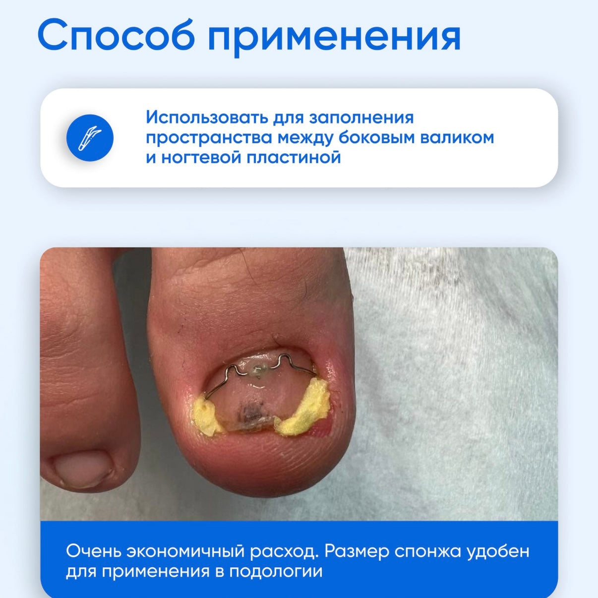 PodolJest Sponges, 30pc