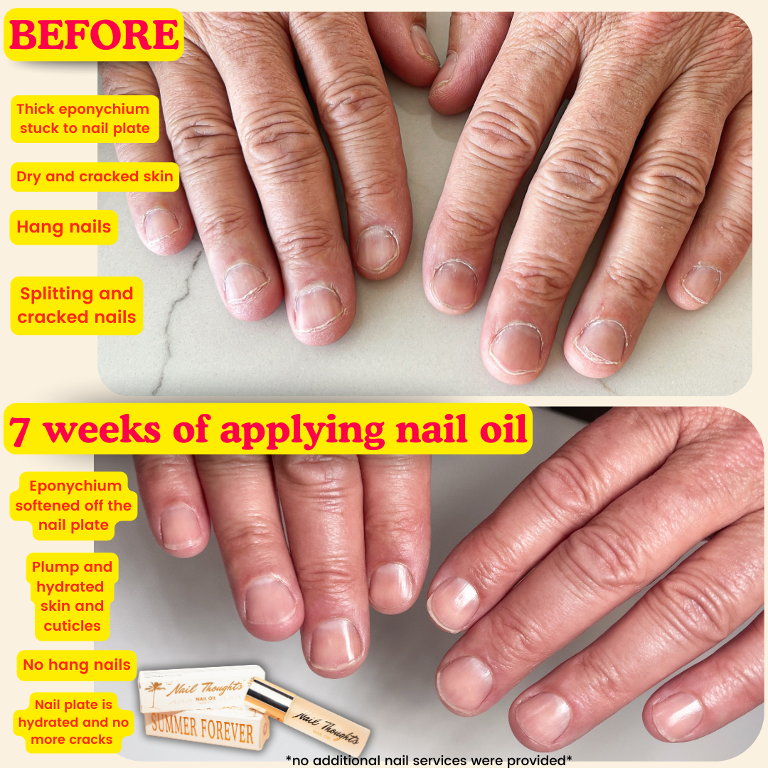Nail Thoughts "SUMMER FOREVER" Nail Oil - 10ml