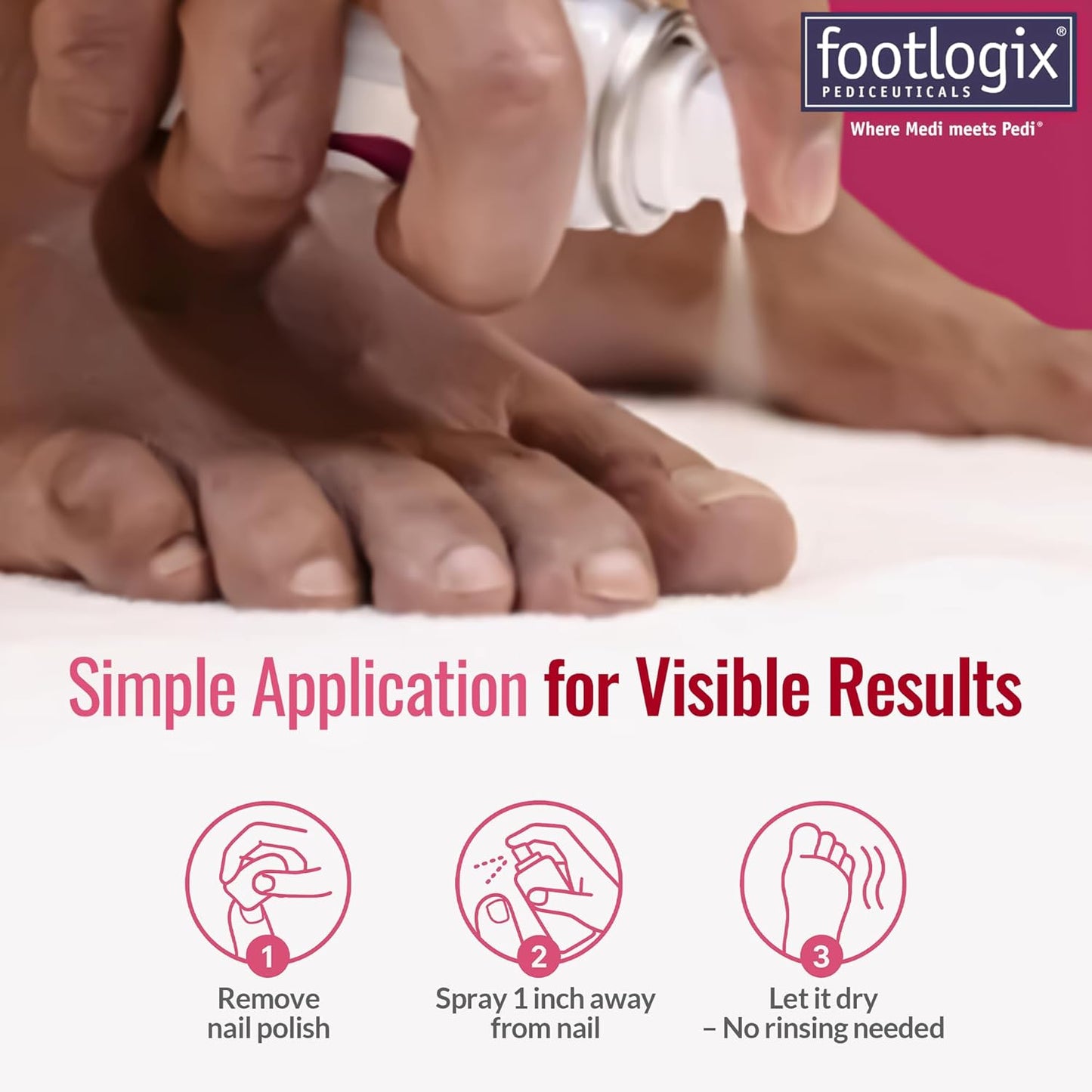 Footlogix - ANTI-FUNGAL TOE TINCTURE SPRAY with SPIRALEEN  44g/1.7oz. Please contact us for Professional (Licensed NailTech) pricing!