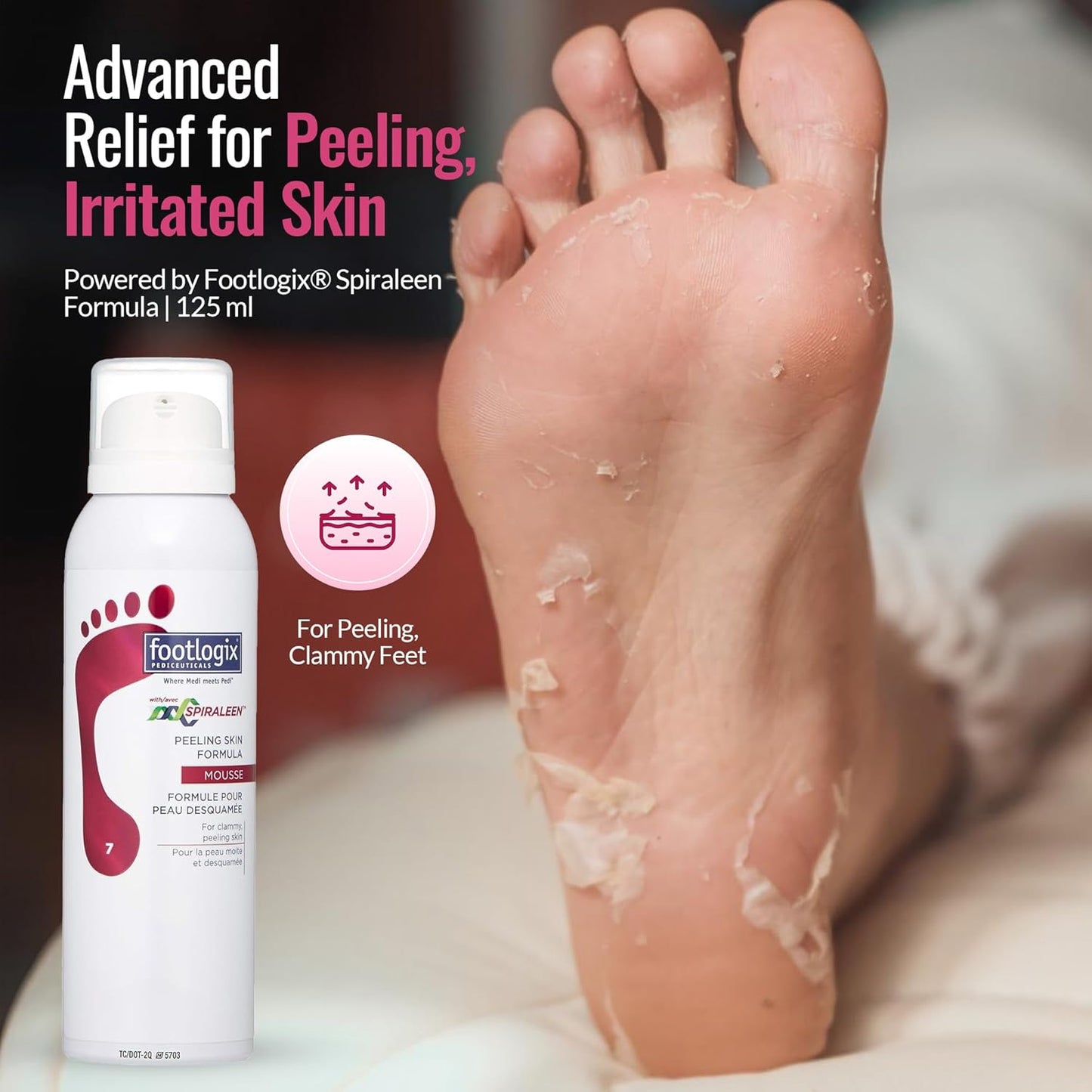 Footlogix - PEELING SKIN FORMULA 120g/4.2oz. Please contact us for Professional (Licensed NailTech) pricing!
