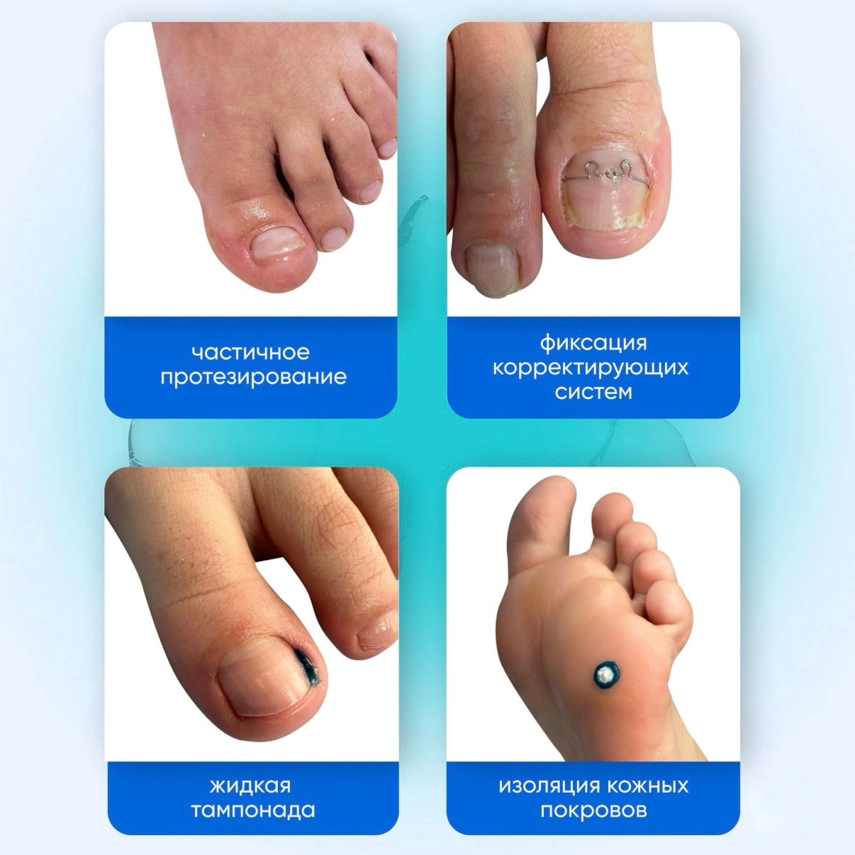 PodolJest TEMPO Multipurpose Paste (3.5g, by Vladmiva)