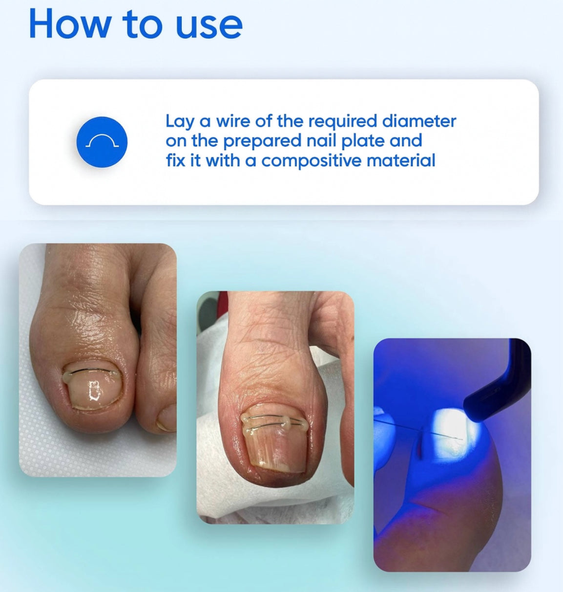 PODOLJEST Titanium archwire #12 , 5 pcs